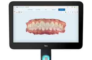3D Dental Scan