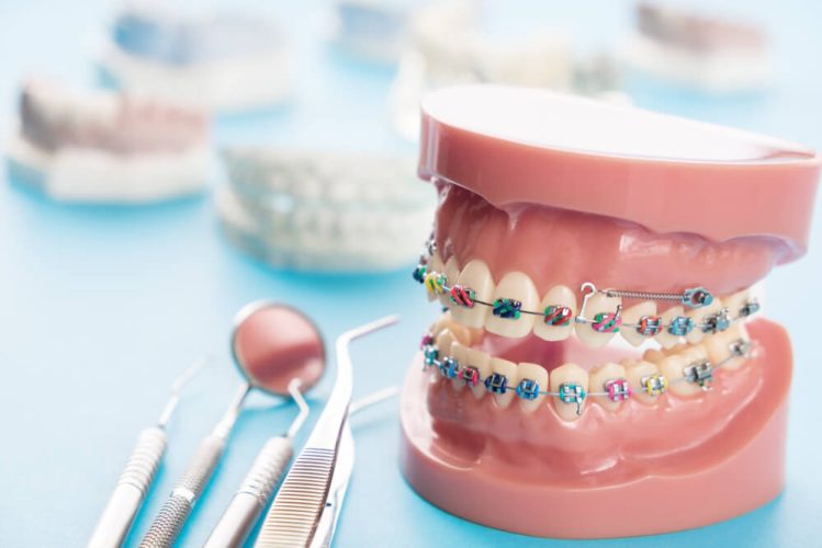 newmarket family dental demonstrates teeth braces treatment using replica