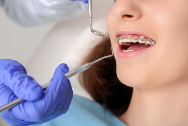 newmarket family dental dentist checks teeth braces on patient